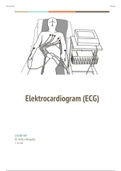 ECG verslag (elektrocardiogram) 